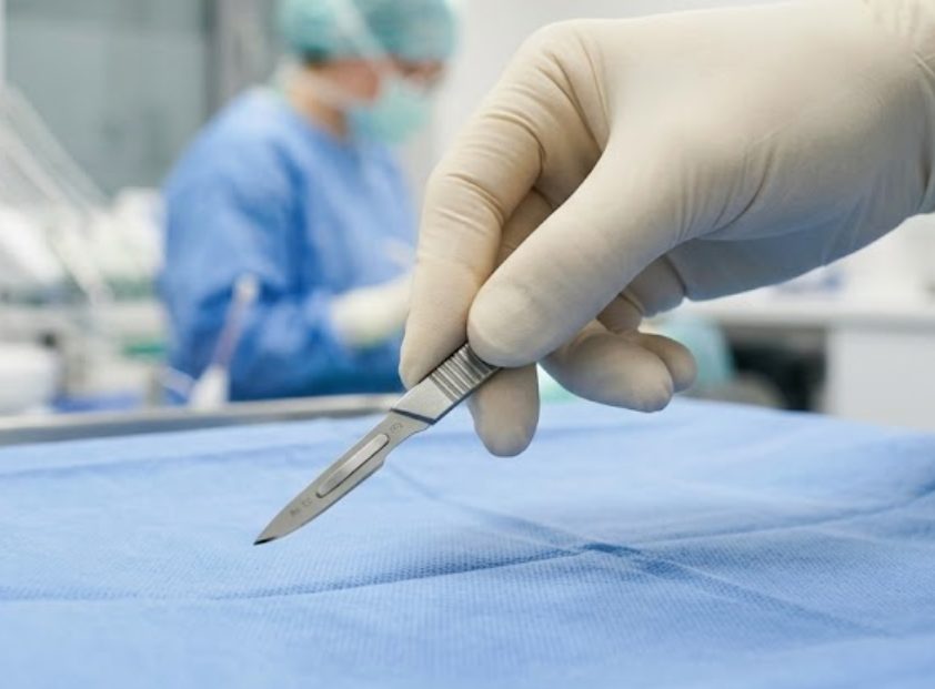 Skalpel w dłoni chirurga na sali zabiegowej